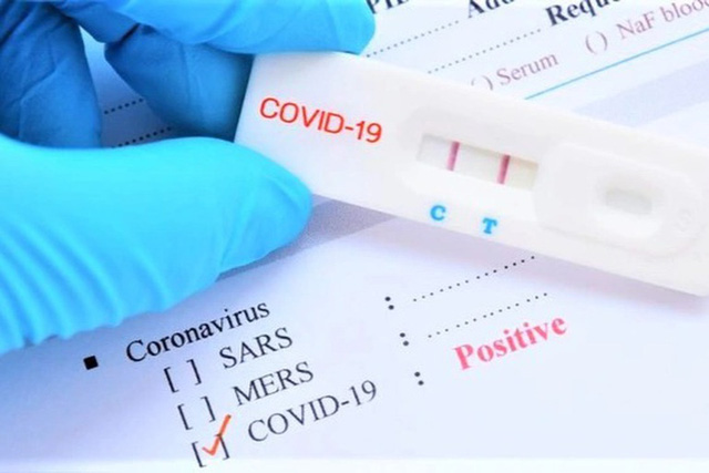 Bộ Y tế đề nghị sớm xem xét đưa kit xét nghiệm COVID-19 vào diện bình ổn giá