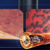 Siêu nội soi Endocyto 520x đánh dấu bước ngoặt trong nội soi tiêu hóa