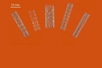 Australia sản xuất stent nhờ công nghệ in 3D