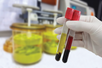 Viện Nghiên cứu Tây Ban Nha chia sẻ miễn phí công nghệ phát hiện, kiểm tra kháng thể Covid-19