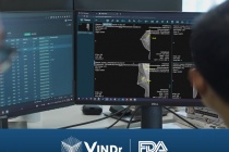 Sản phẩm AI của VinBigdata đạt chứng nhận của FDA, chính thức tiến vào thị trường Mỹ