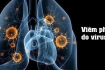 Tổ chức Y tế thế giới thông tin về bệnh do virus gây viêm phổi ở Trung Quốc
