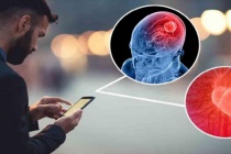 Những thói quen sử dụng smartphone đang làm suy giảm trí nhớ