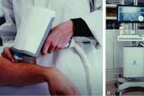 AI giúp phát hiện dấu hiệu ung thư da, giảm nhu cầu sinh thiết