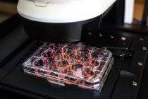 'Vaccine ngừa ung thư của Nga đã sẵn sàng để sử dụng'