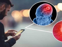 Những thói quen sử dụng smartphone đang làm suy giảm trí nhớ