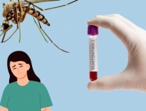 Bệnh Chikungunya lan rộng, Bộ Y tế phát thông báo khẩn tới các địa phương