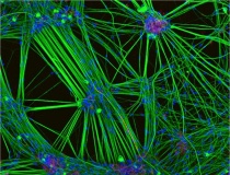 Tế bào não người có thể vận hành máy tính?