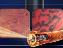 Siêu nội soi Endocyto 520x đánh dấu bước ngoặt trong nội soi tiêu hóa