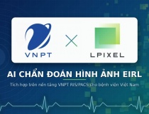 VNPT-IT bắt tay LPIXEL đưa AI chẩn đoán hình ảnh vào bệnh viện Việt