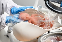 Tử cung nhân tạo: Bước ngoặt y học cứu sống trẻ sinh non