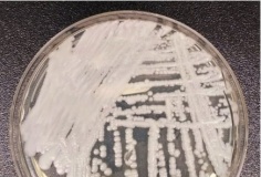 Phát hiện mới mở ra các đích tiềm năng cho kiểm soát dịch và phát triển thuốc điều trị nhiễm trùng do Candida auris