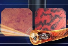 Siêu nội soi Endocyto 520x đánh dấu bước ngoặt trong nội soi tiêu hóa