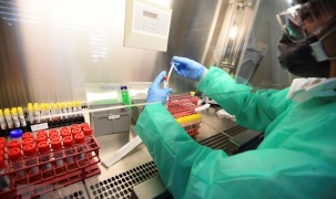 Italy phát triển bộ kit xét nghiệm virus SARS-CoV-2 