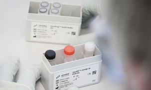 Chuẩn đoán COVID-19 nhanh hơn với bộ xét nghiệm PCR mới tại Singapore