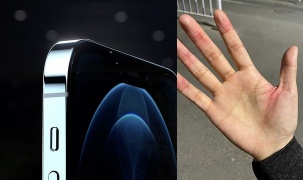 Người dùng phàn nàn iPhone 12 có cạnh sắc tới mức gây đứt tay
