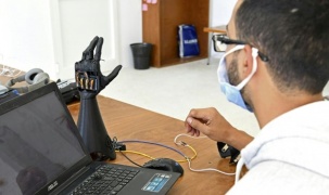 Tunisa phát triển bàn tay nhân tạo bằng công nghệ in 3D