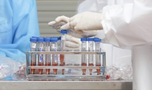 Hà Nội: Công bố kết quả xét nghiệm SARS-CoV-2 của 1.391 trường hợp có nguy cơ cao