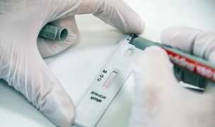 Nga phát triển dụng cụ đo kháng thể đối với virus SARS-CoV-2 tại nhà