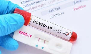 Xét nghiệm máu có thể chẩn đoán bệnh COVID-19