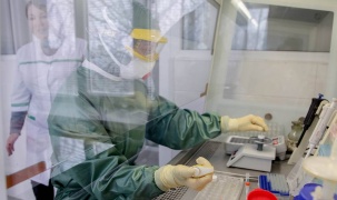 Nga phát triển công nghệ phát hiện virus SARS-CoV-2 ở giai đoạn sớm