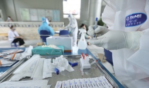 Bộ Y tế yêu cầu niêm yết giá bộ xét nghiệm SARS-CoV-2