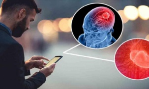 Những thói quen sử dụng smartphone đang làm suy giảm trí nhớ