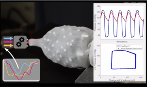 Nhà khoa học Việt kể chuyện chế tạo tim gắn ngoài cơ thể người