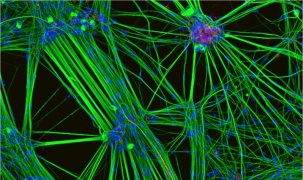 Tế bào não người có thể vận hành máy tính?