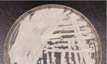 Phát hiện mới mở ra các đích tiềm năng cho kiểm soát dịch và phát triển thuốc điều trị nhiễm trùng do Candida auris